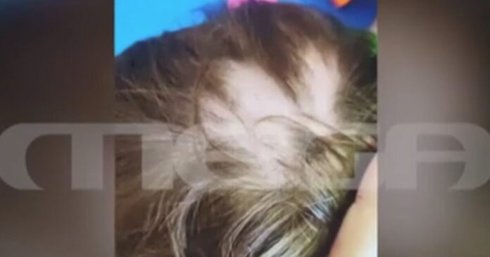 avlwna 2xrono 1200x630.jpg