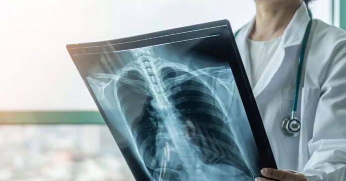 istock 1217561470 1200x675 1 1200x630.jpg