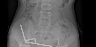 magnitis entero 1200x630.jpg