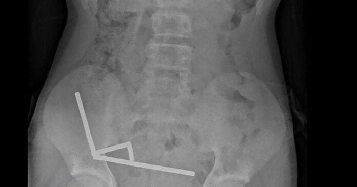 magnitis entero 1200x630.jpg