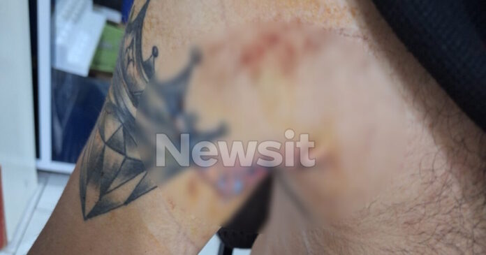 traymata thessaloniki1 1200x630.jpg