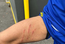 Άρης: Τα σημάδια που άφησε στο πόδι του Ρόουζ το μαρκάρισμα του Ιβανούσετς skaria aris rose 1200x630.jpg