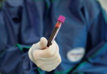 Πώς αποκαλύφθηκε η υπόθεση του Δανού δότη σπέρματος με καρκινικό γονίδιο και γιατί δεν ανιχνεύθηκε test blood.jpg