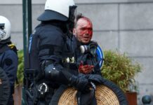 Συγκρούσεις και συλλήψεις στη διαδήλωση αγροτών στις Βρυξέλλες: Ένας τραυματίας wounded man 1200x630.jpg