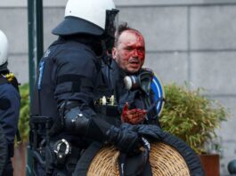 Συγκρούσεις και συλλήψεις στη διαδήλωση αγροτών στις Βρυξέλλες: Ένας τραυματίας wounded man 1200x630.jpg