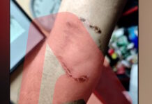 Ομόνοια: Νεαρός έβαλε το πίτμπουλ του να επιτεθεί σε 30χρονο για να τον ληστέψει – «Με έριξε κάτω και το σκυλί με δάγκωνε» skulos omonoia 1200x630.jpg