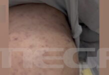 Σε αναστολή η παιδίατρος για την υπόθεση του βρέφους που νοσηλεύεται με μηνιγγίτιδα σε ΜΕΘ στην Πάτρα miniggitida vrefos patra 1200x630.jpg