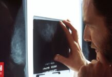 1e56bec0 national cancer institute xrlsv ckmuq unsplash og.jpg