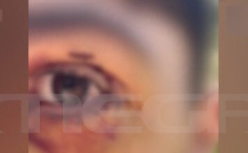 ioannina 16xronos 1200x630.jpg