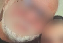 Βέροια: «Το παιδί είναι σε πολύ άσχημη κατάσταση, βρίσκεται ακόμα σε κώμα» λέει ο πατέρας της 24χρονης για τον ξυλοδαρμό από τον 20χρονο veroia1 1200x630.jpg