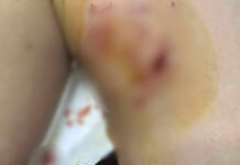 trauma skuli3 1200x630.jpg