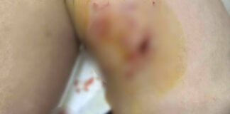 trauma skuli3 1200x630.jpg