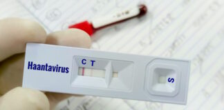hantavirus 4 1200x630.jpg