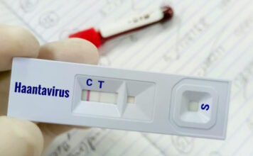 hantavirus 4 1200x630.jpg