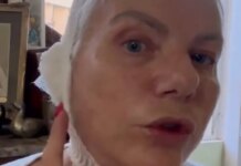 Η Νανά Παλαιτσάκη έκανε λίφτινγκ στον λαιμό: «Ο γιατρός αφαίρεσε αυτή την χαλάρωση που με ενοχλούσε»